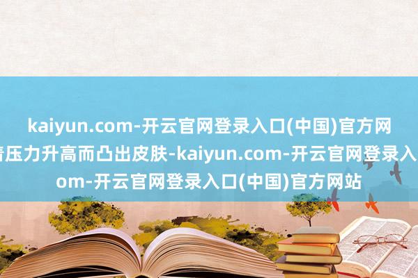kaiyun.com-开云官网登录入口(中国)官方网站因此更容易跟着压力升高而凸出皮肤-kaiyun.com-开云官网登录入口(中国)官方网站